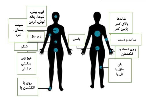 ناحیه ی تحت درمان لیزر موهای زائد