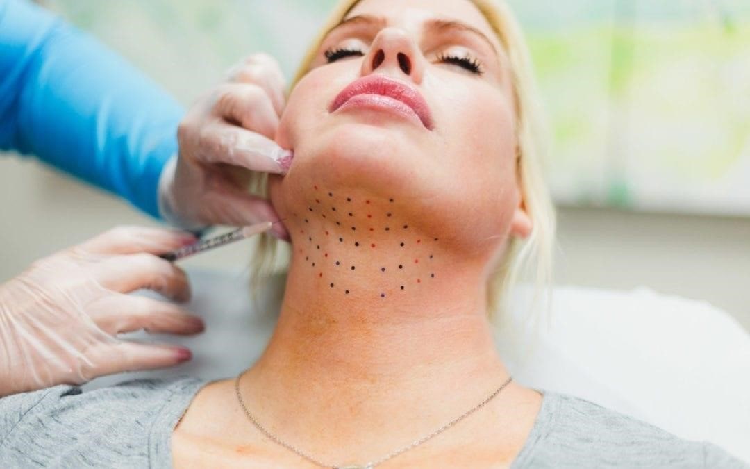 مراحل و نحوه لیفت غبغب با مزوژل
